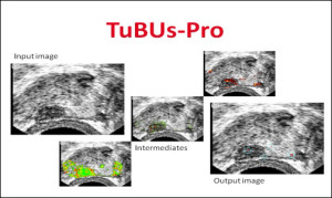 TuBUs-Pro_Image_1
